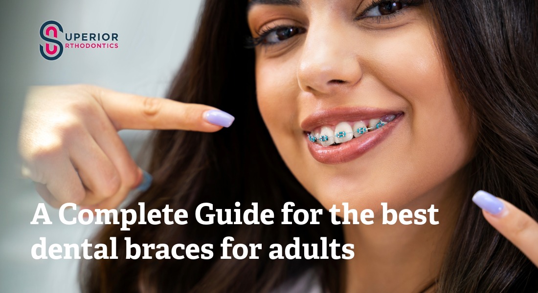 best dental braces for adults